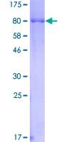 12.5% SDS-PAGE Stained with Coomassie Blue.